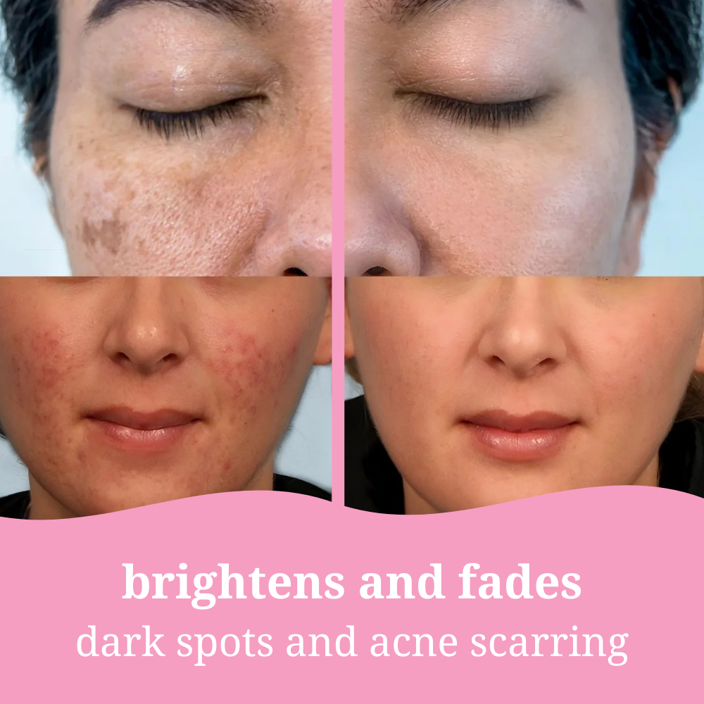 Mae & West™ Brightening Pads