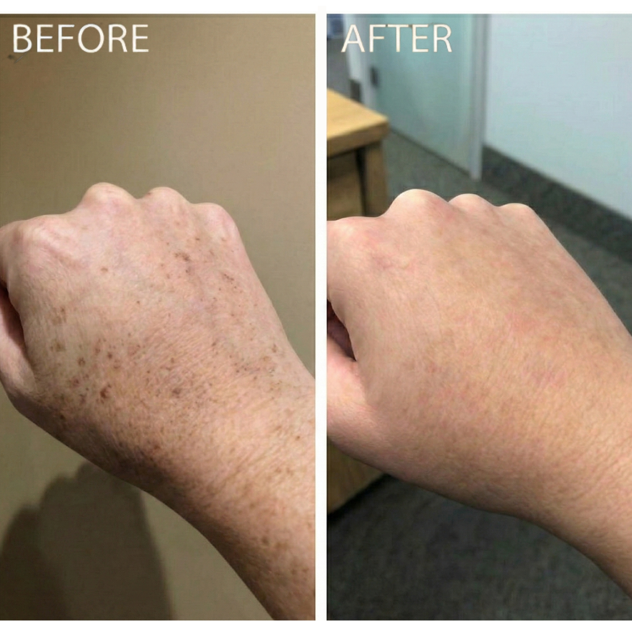 Mae & West™ Brightening Pads