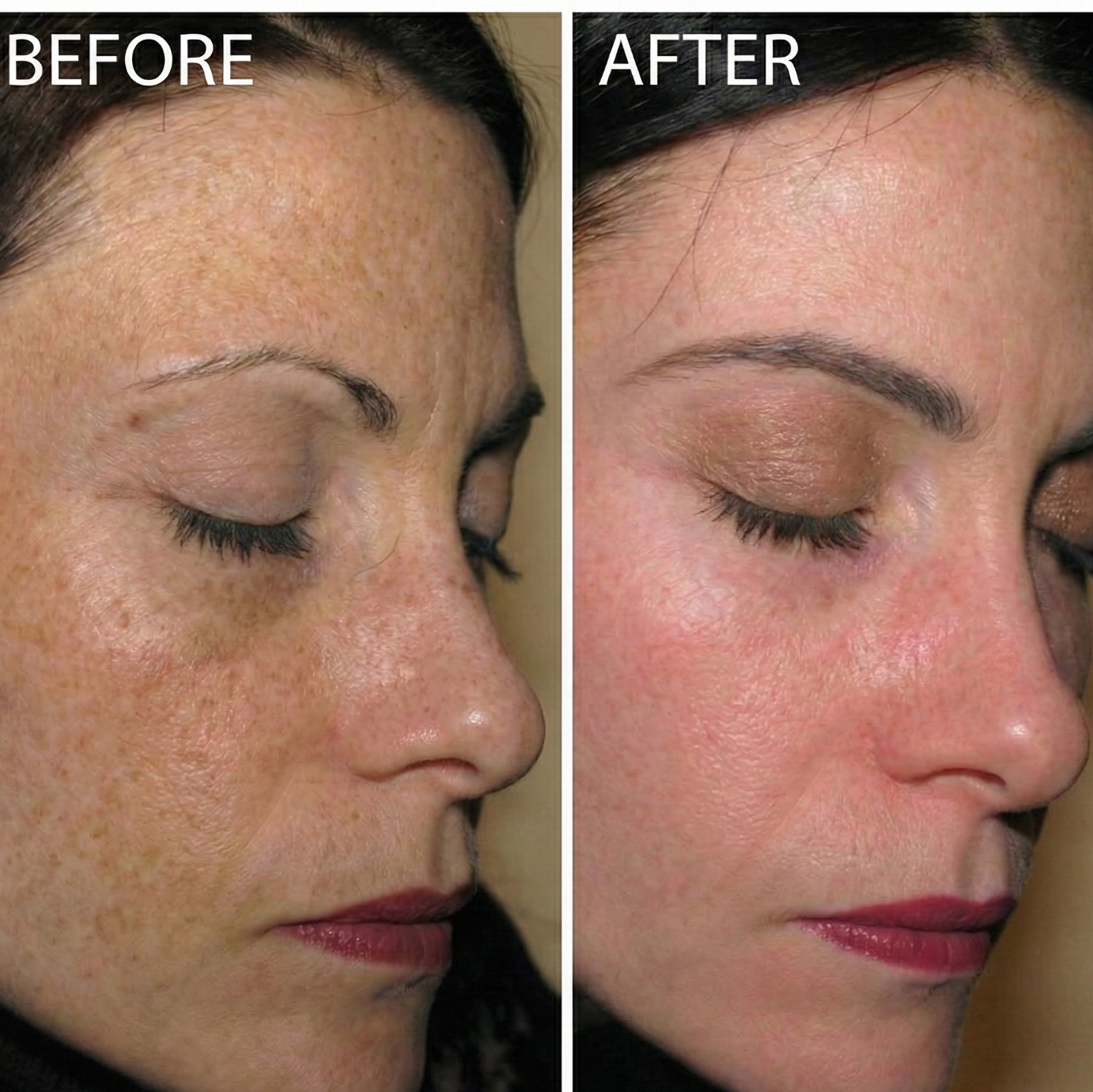 Mae & West™ Brightening Pads