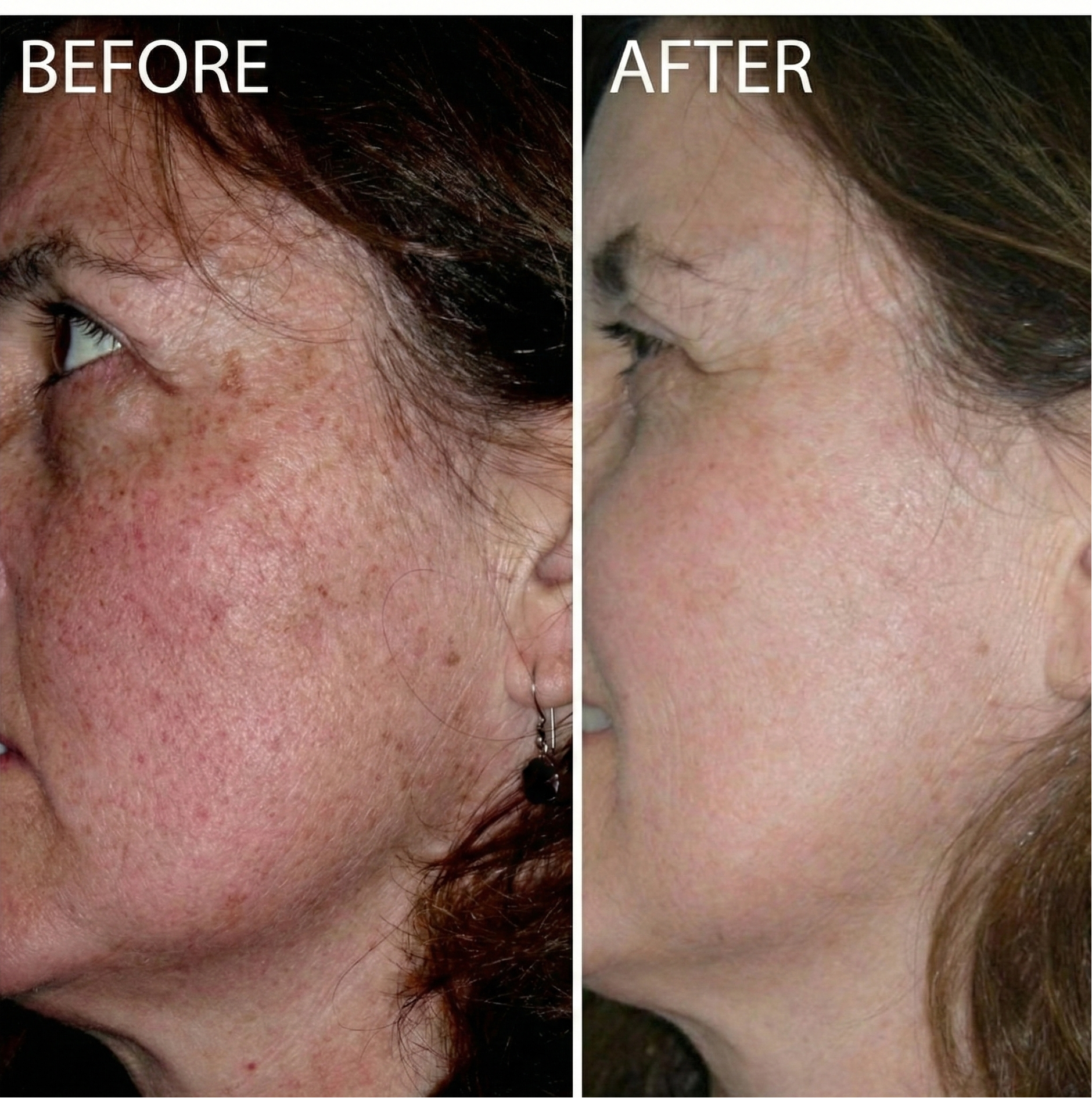 Mae & West™ Brightening Pads